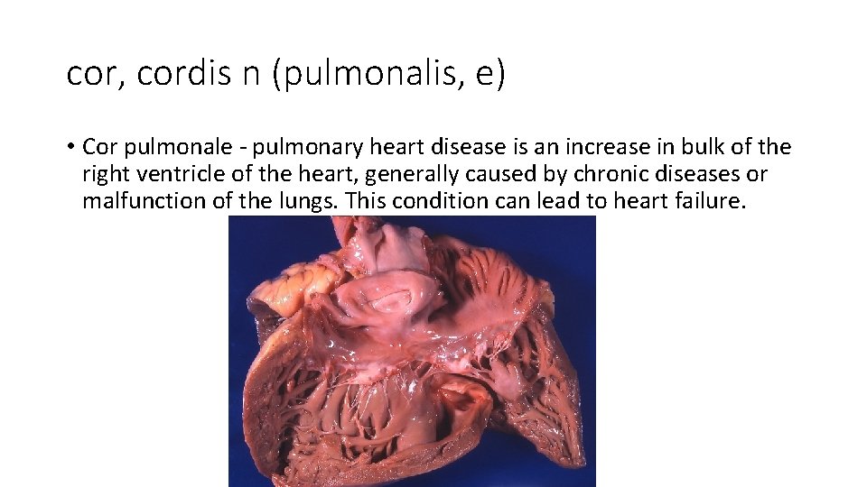 cor, cordis n (pulmonalis, e) • Cor pulmonale - pulmonary heart disease is an