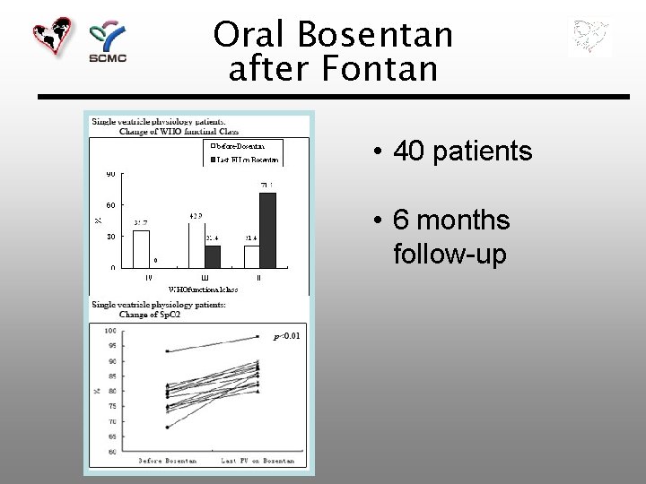 Oral Bosentan after Fontan • 40 patients • 6 months follow-up 