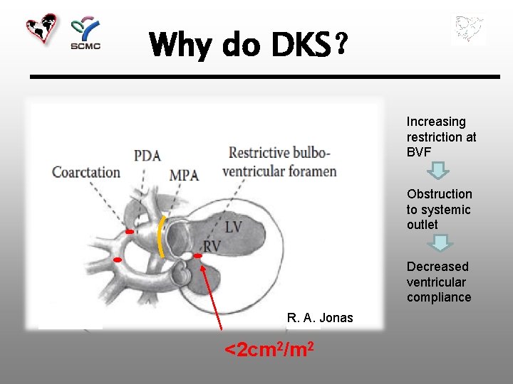 Why do DKS？ Increasing restriction at BVF Obstruction to systemic outlet Decreased ventricular compliance