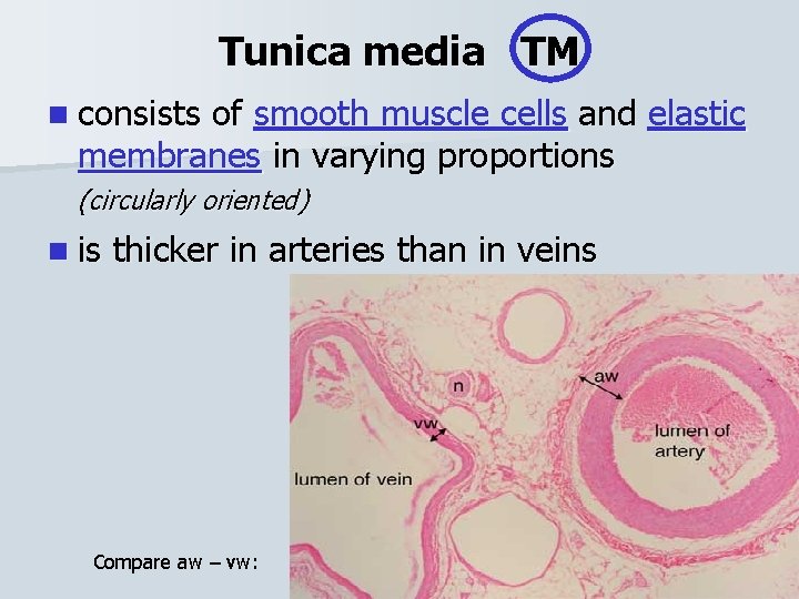 Tunica media TM n consists of smooth muscle cells and elastic membranes in varying