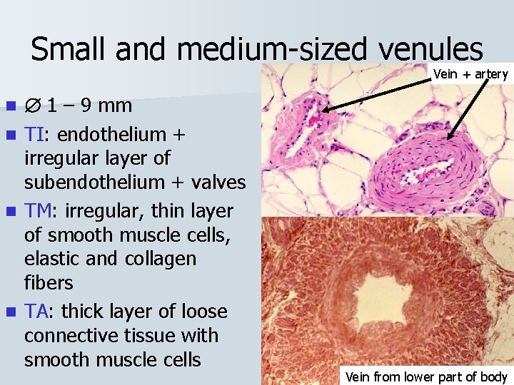 Small and medium-sized venules Vein + artery 1 – 9 mm n TI: endothelium