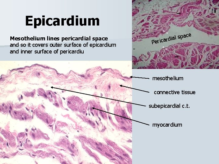 Epicardium Mesothelium lines pericardial space and so it covers outer surface of epicardium and