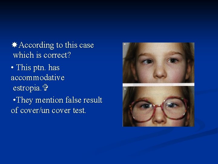  According to this case which is correct? • This ptn. has accommodative estropia.