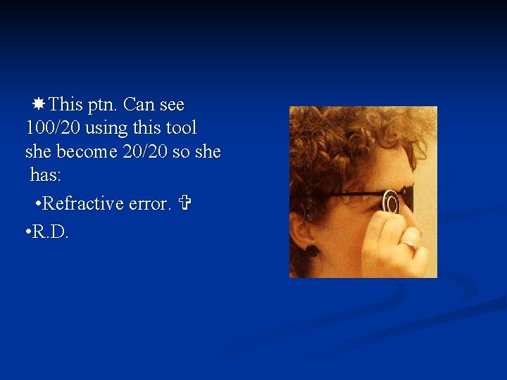  This ptn. Can see 100/20 using this tool she become 20/20 so she