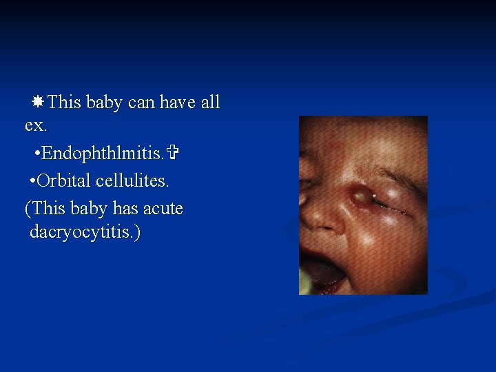  This baby can have all ex. • Endophthlmitis. • Orbital cellulites. (This baby