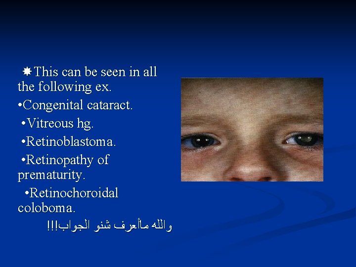  This can be seen in all the following ex. • Congenital cataract. •