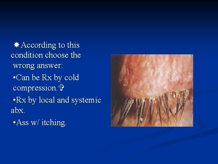  According to this condition choose the wrong answer: • Can be Rx by