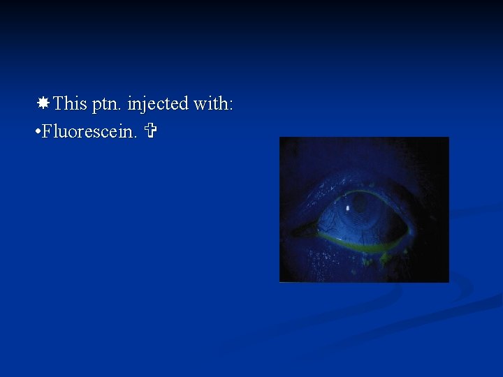  This ptn. injected with: • Fluorescein. 