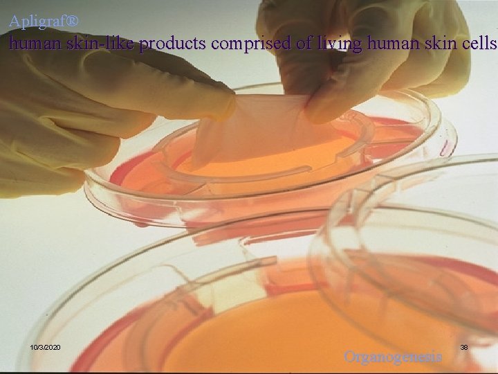 Apligraf® human skin-like products comprised of living human skin cells 10/3/2020 Organogenesis 38 Apligraf® human skin-like products comprised of living human skin cells 10/3/2020 Organogenesis 38