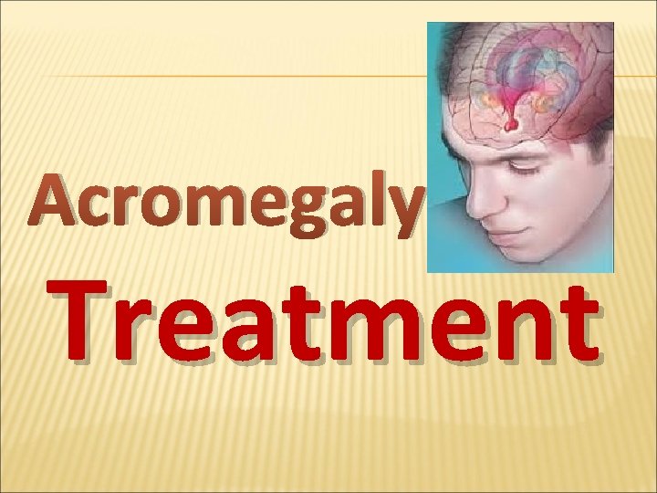 Acromegaly Treatment 