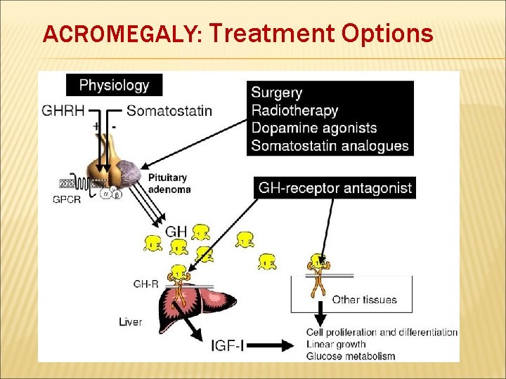 ACROMEGALY: Treatment Options 