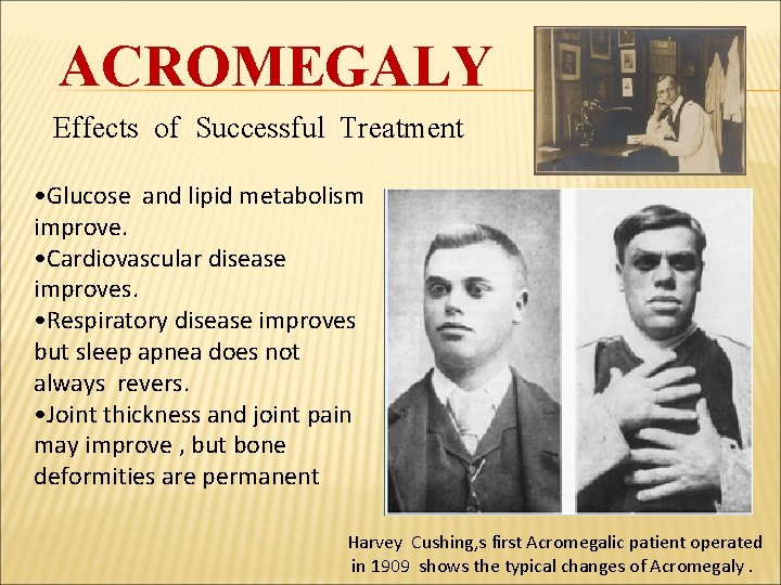 ACROMEGALY Effects of Successful Treatment • Glucose and lipid metabolism improve. • Cardiovascular disease