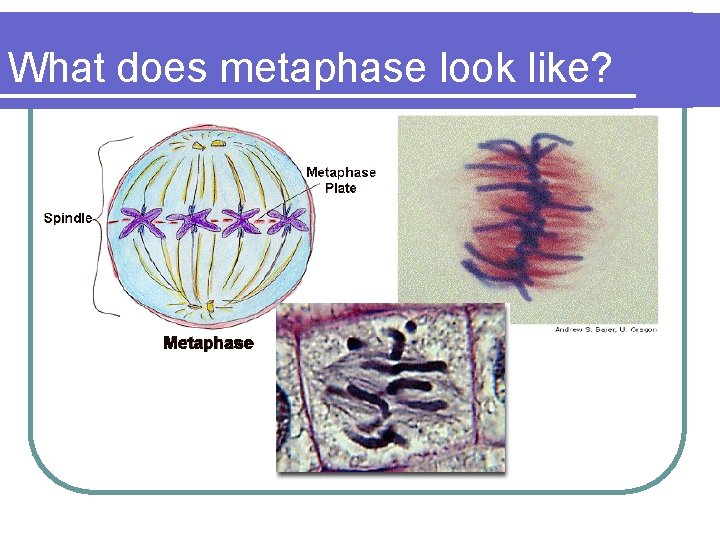 What does metaphase look like? 