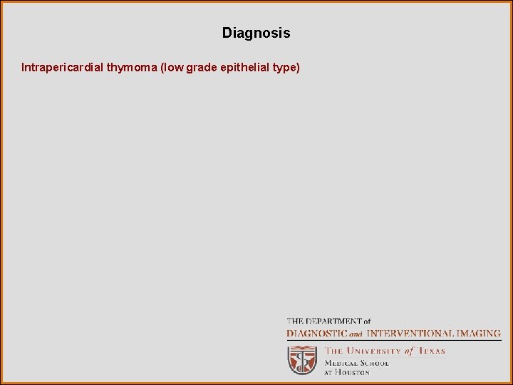 Diagnosis Intrapericardial thymoma (low grade epithelial type) 