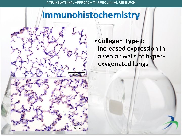 A TRANSLATIONAL APPROACH TO PRECLINICAL RESEARCH Immunohistochemistry • Collagen Type I: Increased expression in