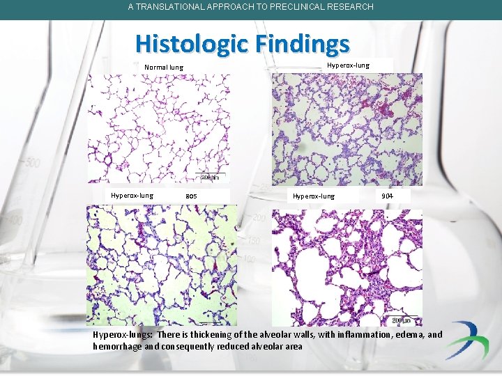 A TRANSLATIONAL APPROACH TO PRECLINICAL RESEARCH Histologic Findings Hyperox-lung Normal lung 152 Hyperox-lung 805