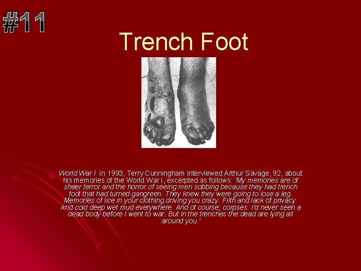 #11 Trench Foot World War I In 1993, Terry Cunningham interviewed Arthur Savage, 92,