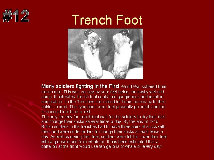 #12 Trench Foot Many soldiers fighting in the First World War suffered from trench