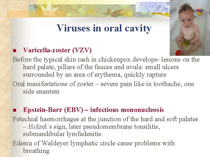 Viruses in oral cavity Varicella-zoster (VZV) Before the typical skin rash in chickenpox develops-
