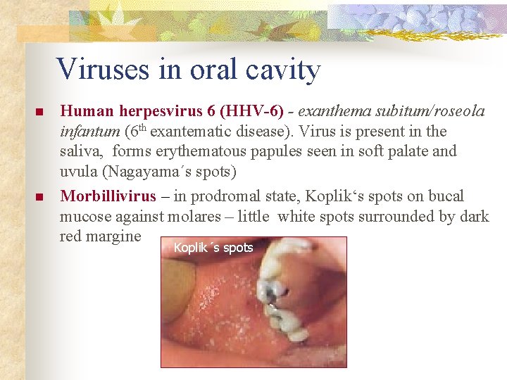 Viruses in oral cavity n n Human herpesvirus 6 (HHV-6) - exanthema subitum/roseola infantum