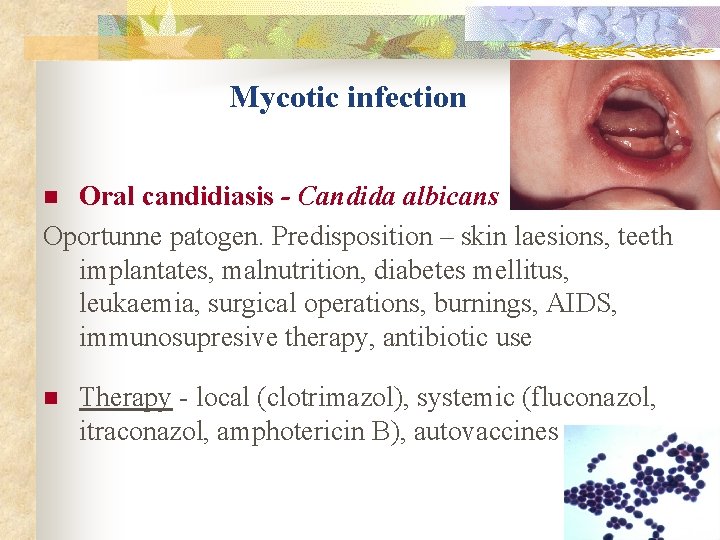 Mycotic infection Oral candidiasis - Candida albicans Oportunne patogen. Predisposition – skin laesions, teeth