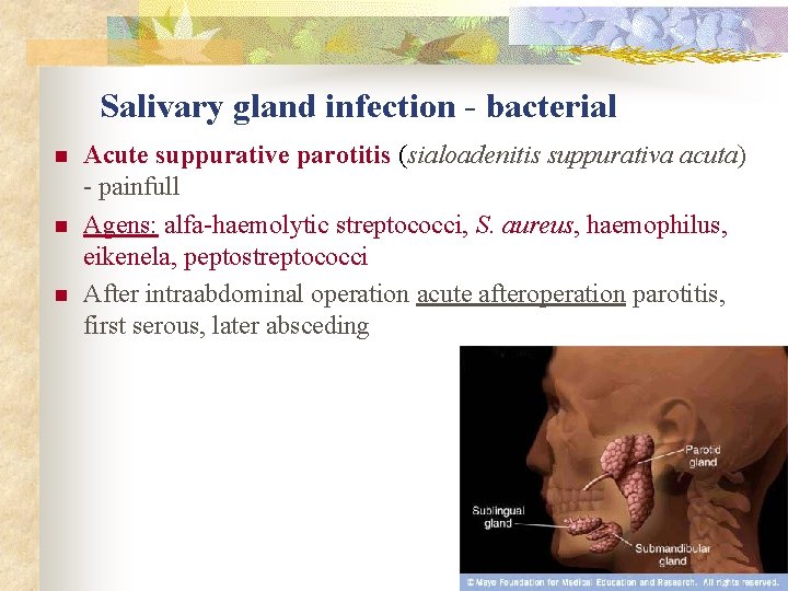 Salivary gland infection - bacterial n n n Acute suppurative parotitis (sialoadenitis suppurativa acuta)