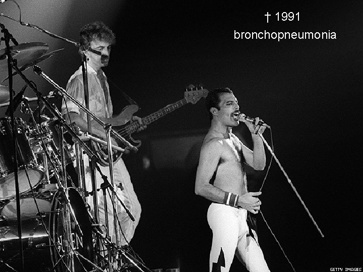 † 1991 bronchopneumonia † 1991 bronchopneumonia