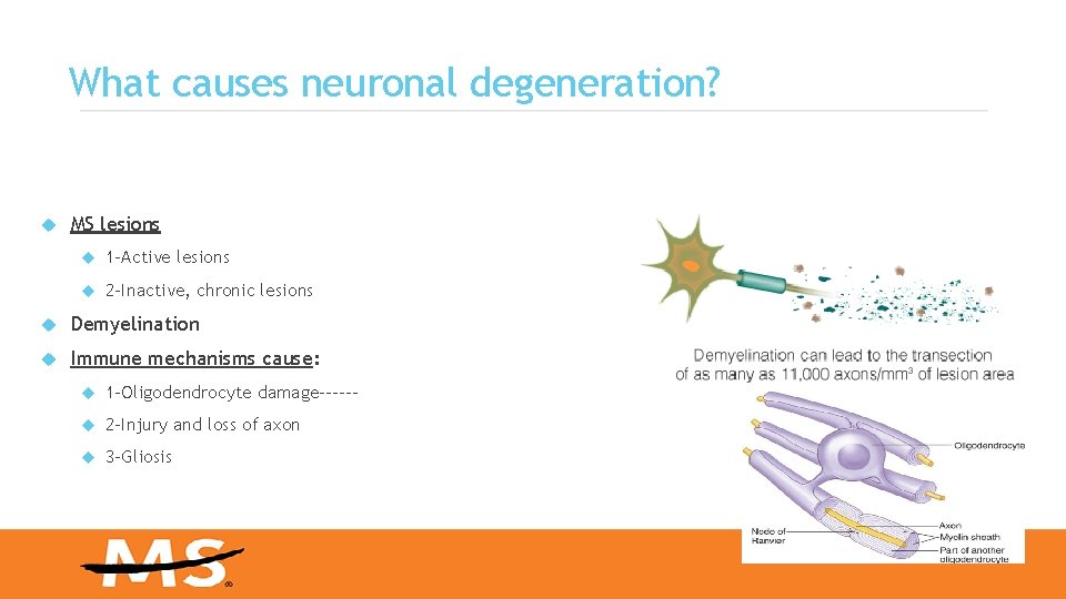 What causes neuronal degeneration? MS lesions 1 -Active lesions 2 -Inactive, chronic lesions Demyelination