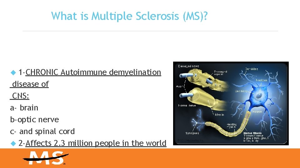 What is Multiple Sclerosis (MS)? 1 -CHRONIC Autoimmune demyelination disease of CNS: a- brain