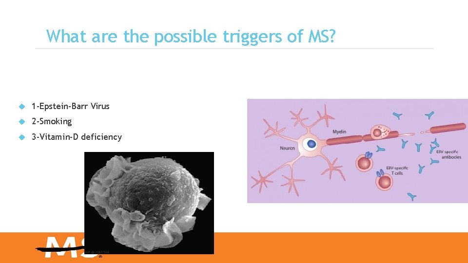 What are the possible triggers of MS? 1 -Epstein-Barr Virus 2 -Smoking 3 -Vitamin-D