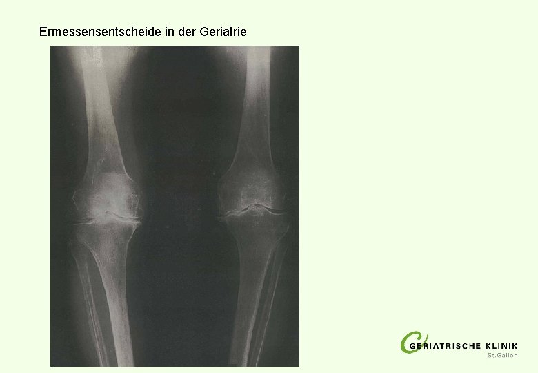 Ermessensentscheide in der Geriatrie Ermessensentscheide in der Geriatrie
