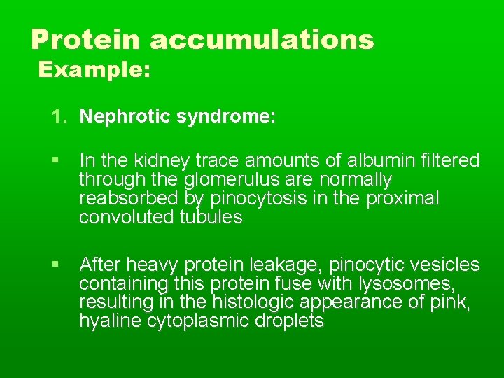 Protein accumulations Example: 1. Nephrotic syndrome: In the kidney trace amounts of albumin filtered