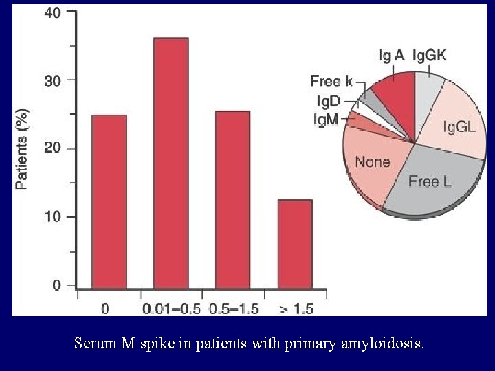 Serum M spike in patients with primary amyloidosis. 