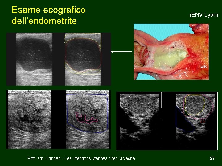 Esame ecografico dell’endometrite Prof. Ch. Hanzen - Les infections utérines chez la vache (ENV
