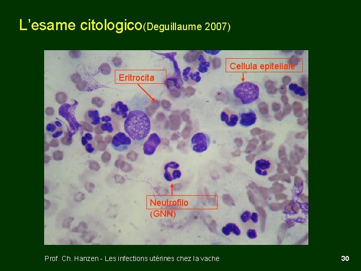 L’esame citologico(Deguillaume 2007) Cellula epiteliale Eritrocita Neutrofilo (GNN) Prof. Ch. Hanzen - Les infections