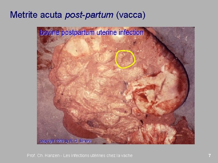 Metrite acuta post-partum (vacca) Prof. Ch. Hanzen - Les infections utérines chez la vache