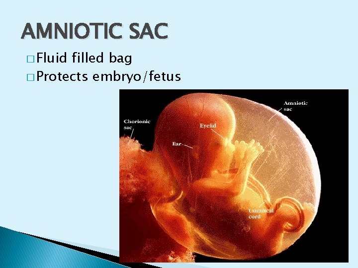 AMNIOTIC SAC � Fluid filled bag � Protects embryo/fetus 