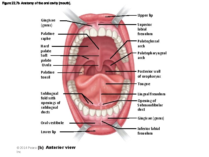 Figure 22. 7 b Anatomy of the oral cavity (mouth). Upper lip Gingivae (gums)