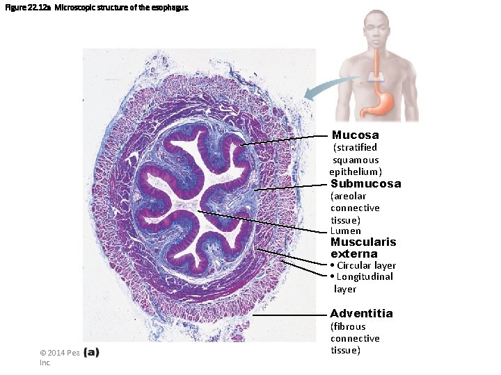 Figure 22. 12 a Microscopic structure of the esophagus. Mucosa (stratified squamous epithelium) Submucosa