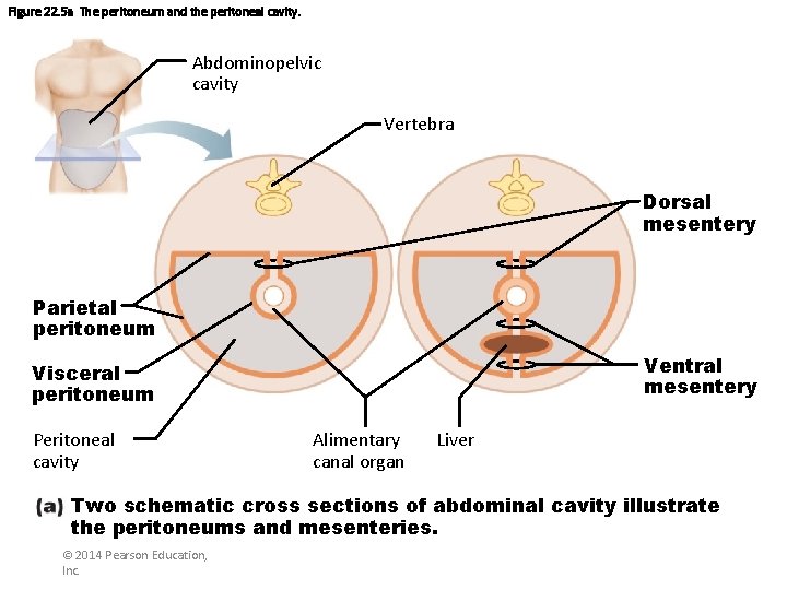 Figure 22. 5 a The peritoneum and the peritoneal cavity. Abdominopelvic cavity Vertebra Dorsal