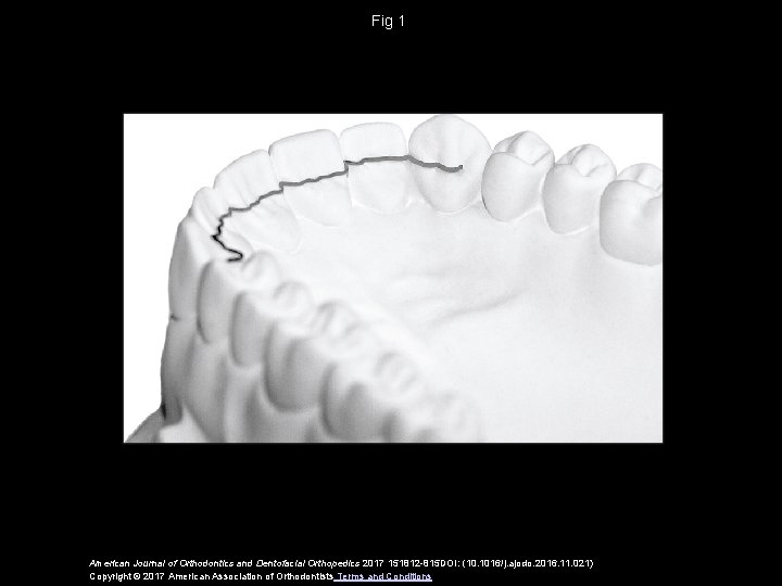 Fig 1 American Journal of Orthodontics and Dentofacial Orthopedics 2017 151812 -815 DOI: (10.