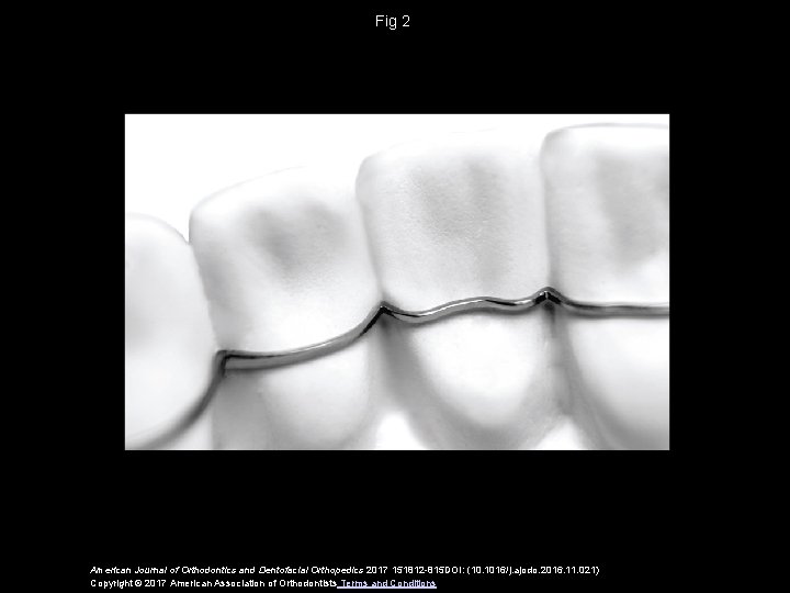 Fig 2 American Journal of Orthodontics and Dentofacial Orthopedics 2017 151812 -815 DOI: (10.