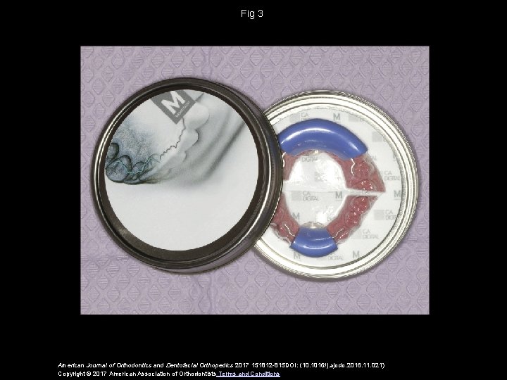 Fig 3 American Journal of Orthodontics and Dentofacial Orthopedics 2017 151812 -815 DOI: (10.