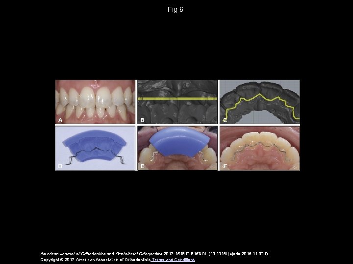 Fig 6 American Journal of Orthodontics and Dentofacial Orthopedics 2017 151812 -815 DOI: (10.