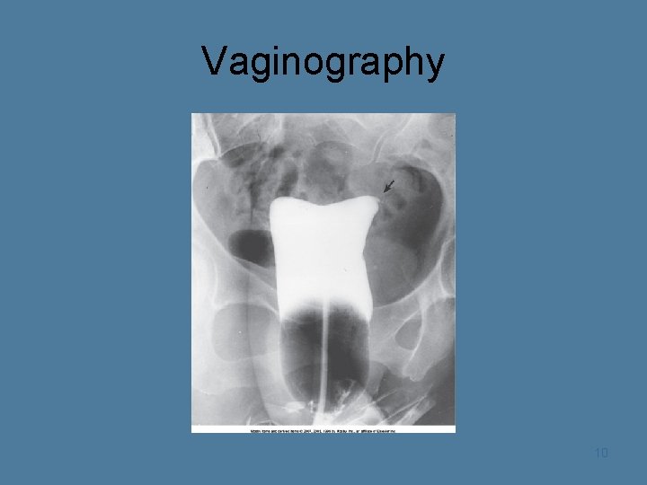 Vaginography 10 