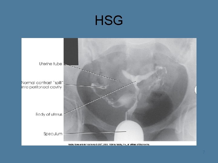 HSG 7 