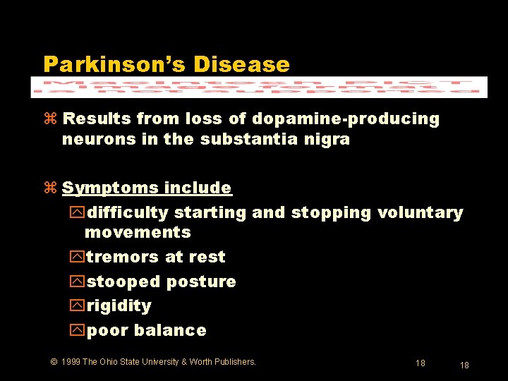 Parkinson’s Disease z Results from loss of dopamine-producing neurons in the substantia nigra z