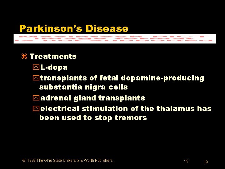 Parkinson’s Disease z Treatments y. L-dopa ytransplants of fetal dopamine-producing substantia nigra cells yadrenal