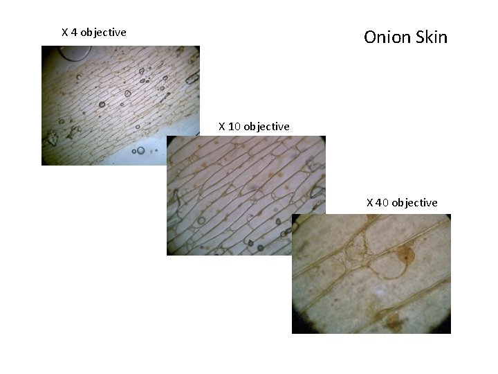 Onion Skin X 4 objective X 10 objective X 40 objective 