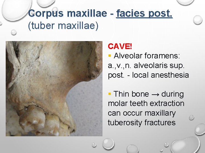 Corpus maxillae - facies post. (tuber maxillae) CAVE! § Alveolar foramens: a. , v.